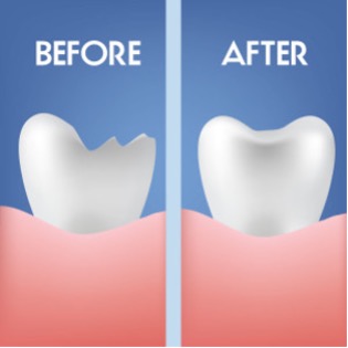 A graphic of before & after cosmeitc dentistry